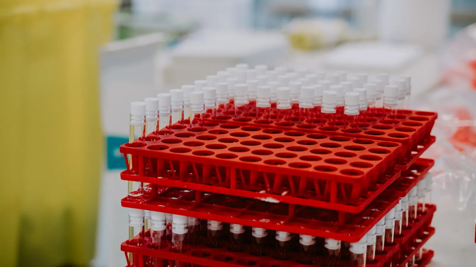Rode rekjes met afgesloten bloedbuisjes staan opgestapeld in een laboratorium.