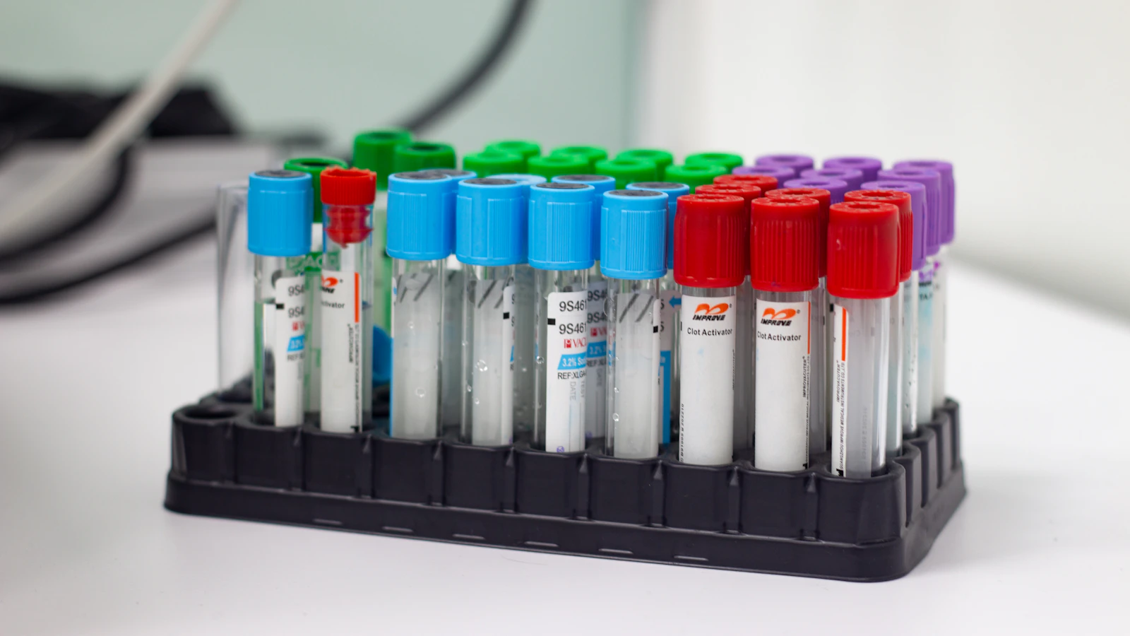 Gekleurde buisjes bloed klaar voor analyse in het laboratorium.